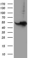 HARS2 Antibody (clone OTI3F1)