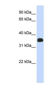 C2orf47 Antibody (C-Terminus)