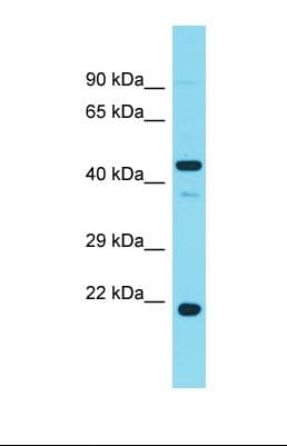 Polyclonal Rabbit anti-Human PHAX Antibody (aa153-202, WB)