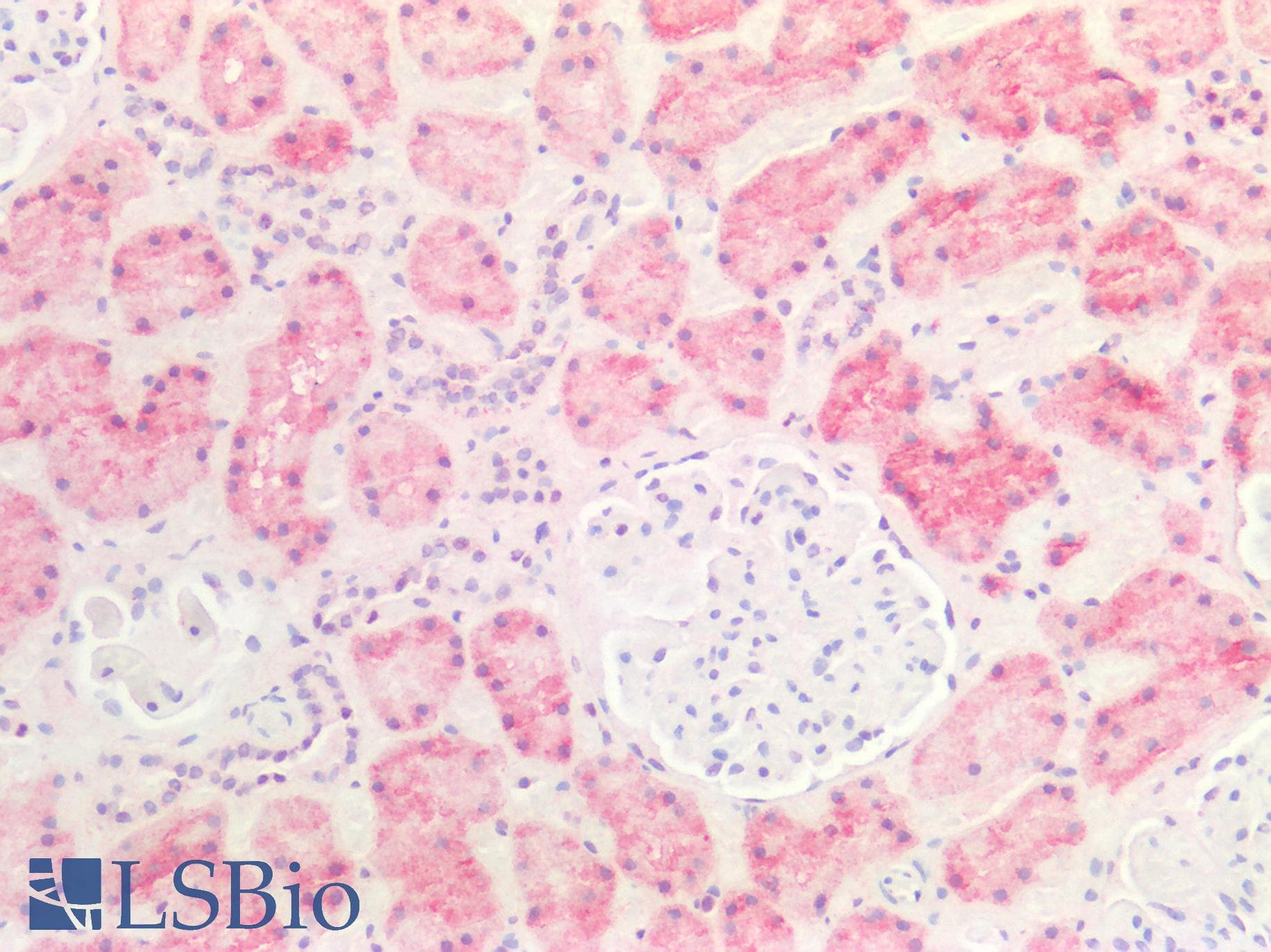 PathPlus™ GLS / Glutaminase Antibody