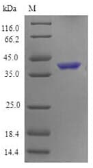 Mouse TNFRSF4 / CD134 / OX40 Protein (Recombinant 6His-SUMO, N-terminus)