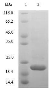 Rhesus monkey IL-10 Protein (Recombinant 10His, C-terminus)