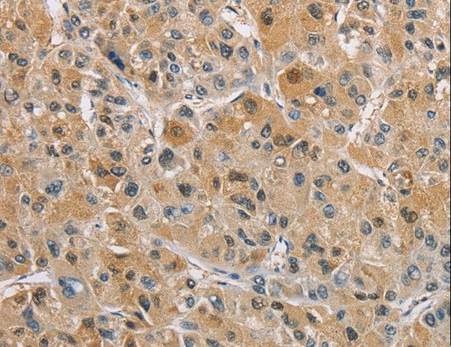 IHC-plus™ Polyclonal Rabbit anti-Human NAPSA / NAPA / Napsin A Antibody (IHC)