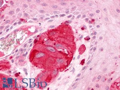 PathPlus™ Polyclonal Rabbit anti-Human LPAR1 / LPA1 / EDG2 Antibody (N-Terminus, IHC)