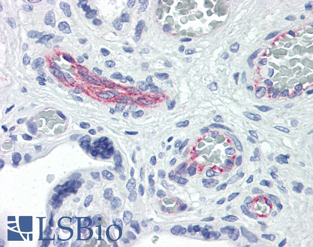 IHC-plus™ RHOE / RND3 Antibody (clone 1D2)