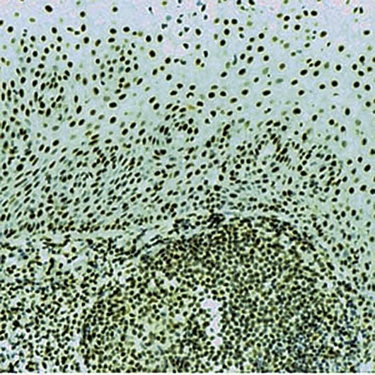 Monoclonal Mouse anti-Human RPA2 / RFA2 / RPA34 Antibody (clone 9H8, IHC)