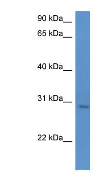 UTP23 Antibody (C-Terminus)