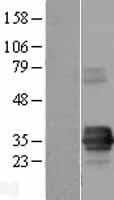 TIRAP Protein (Over-Expression Lysate Myc-DDK (Flag))