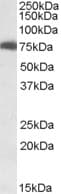 Harmonin / USH1C Antibody (aa2-14)