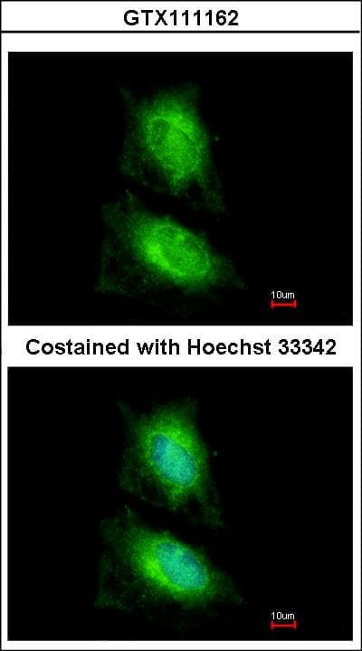 MAPK8IP2 / JIP2 Antibody