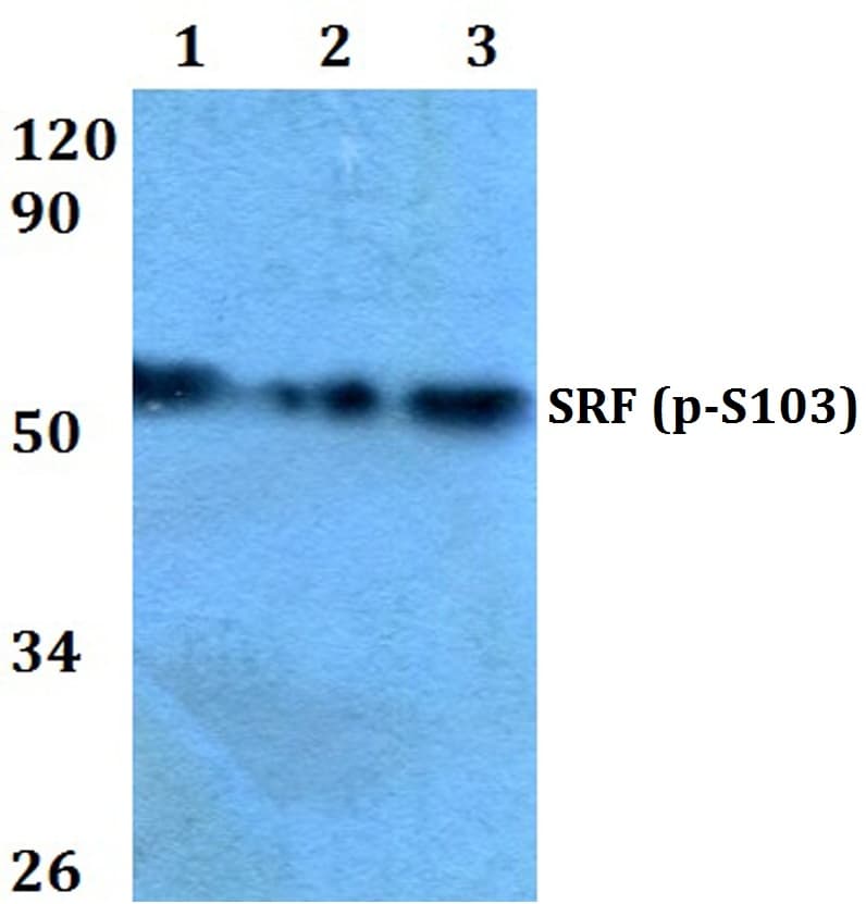 SRF / Serum Response Factor Antibody (phospho-Ser103)