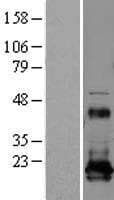 REEP5 Protein (Over-Expression Lysate Myc-DDK (Flag))