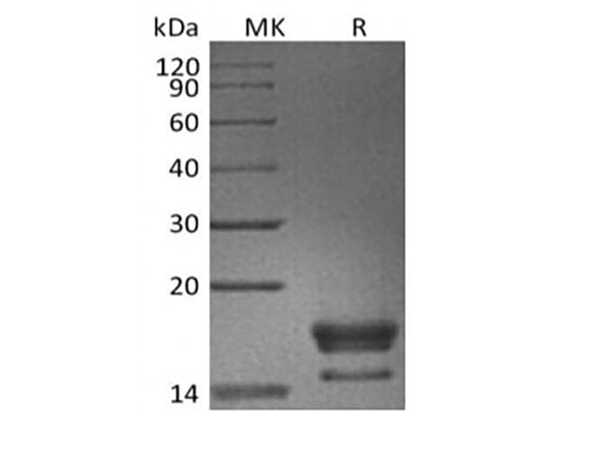 Cynomolgus ANGPTL4 Protein (Recombinant 6His, C-terminus)