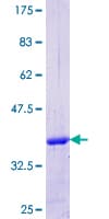 Human FSP27 / CIDEC Protein (Recombinant GST, N-terminus)