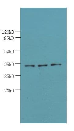 OTUD6B Antibody