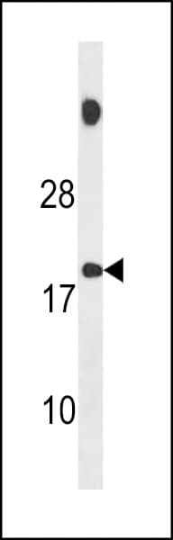 SPANXB2 Antibody (aa17-47)