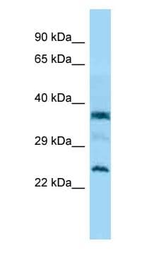 C7orf61 Antibody (C-Terminus)