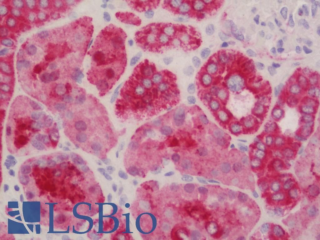 IHC-plus™ Polyclonal Rabbit anti-Human SHMT / SHMT1 Antibody (aa453-483, IHC, WB)