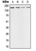 Polyclonal Rabbit anti-Human TP53BP1 / 53BP1 Antibody (N-Terminus, IHC, IF, WB)
