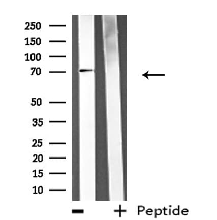 Polyclonal Rabbit anti-Human ATG16L1 / ATG16L Antibody (IF, WB)
