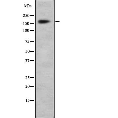 SMARCA2 / BRM Antibody