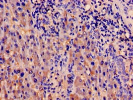 Polyclonal Rabbit anti-Human PDK1 Antibody (IHC, WB)