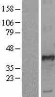 FOSL2 / FRA-2 Protein (Over-Expression Lysate Myc-DDK (Flag))