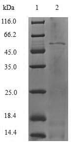 Human HNRPM / HNRNPM Protein (Recombinant 6His-SUMO, N-terminus)
