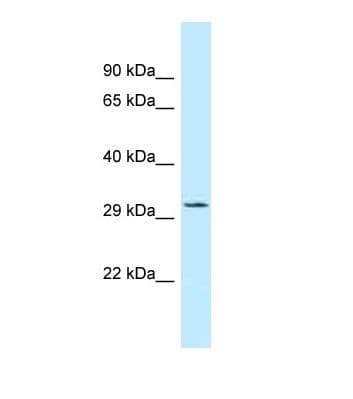 Polyclonal Rabbit anti-Human TIPRL / TIP Antibody (C-Terminus, WB)