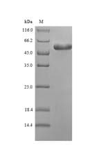 Mycoplasma pneumoniae PIP / GCDFP-15 Protein (Recombinant 6His-SUMO, N-terminus)