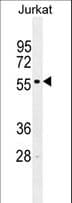 Polyclonal Rabbit anti-Human IRF2 Antibody (aa225-255, WB)