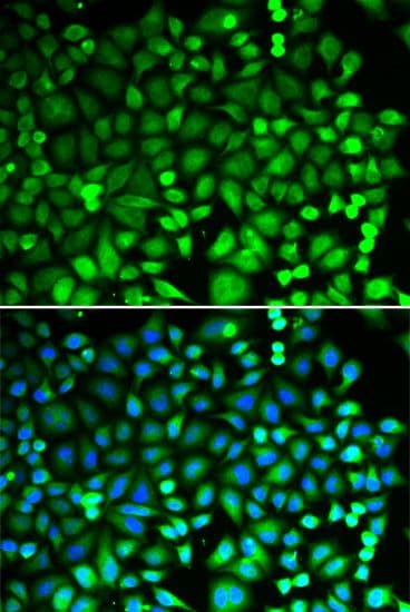 Polyclonal Rabbit anti-Human PSMB2 Antibody (IHC, IF, WB)