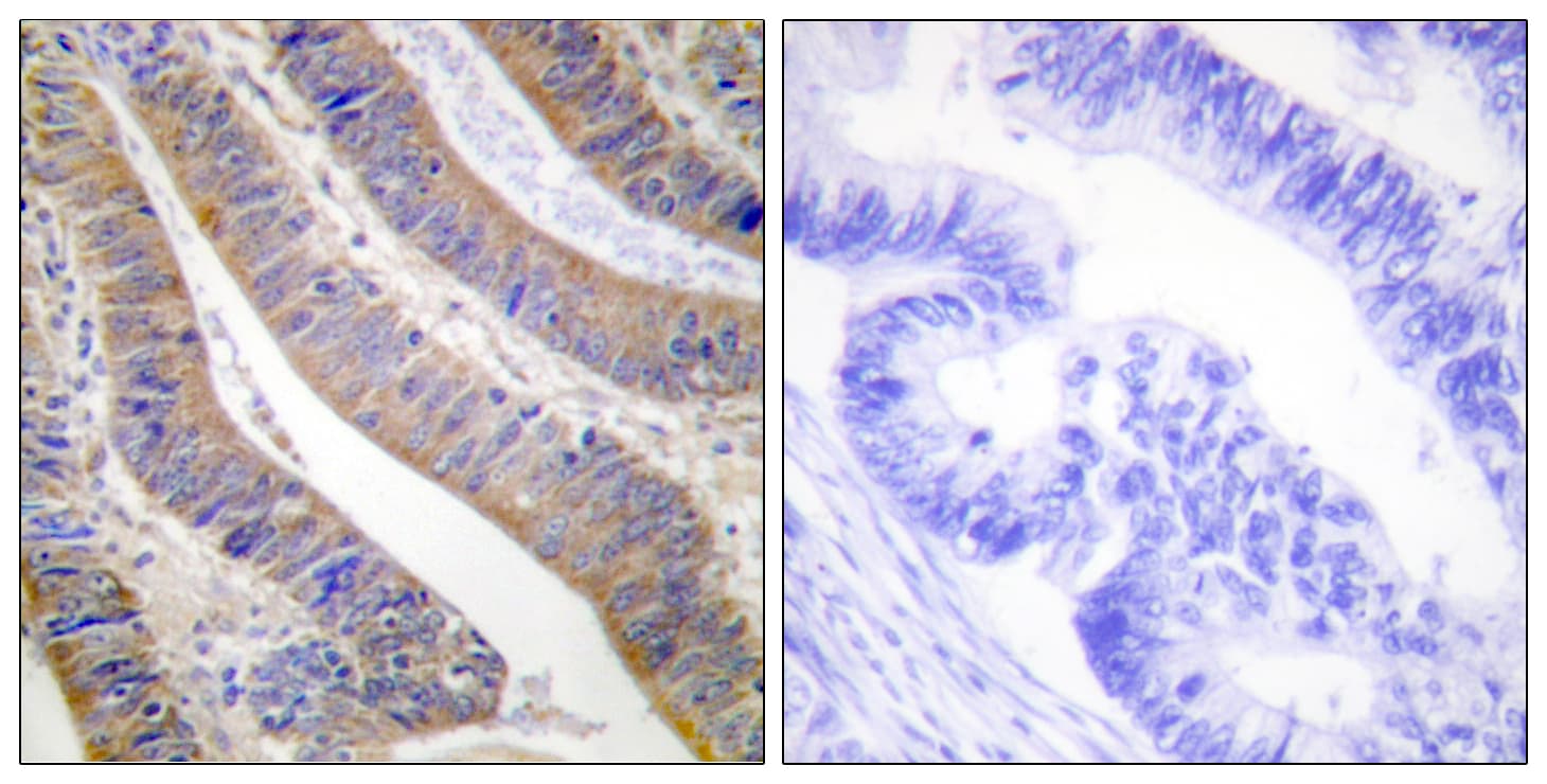Polyclonal Rabbit anti-Human NCF1 / p47phox / p47 phox Antibody (aa331-380, IHC, WB)