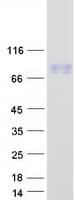 Human CD105 Protein (Recombinant Myc-DDK (Flag))