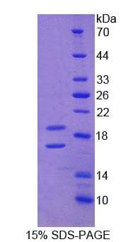 Human CD105 Protein (Recombinant His)