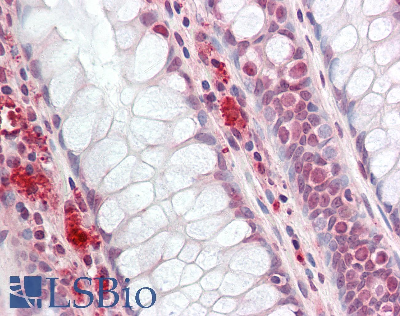 Polyclonal Rabbit anti-Human SMARCE1 / BAF57 Antibody (N-Terminus, IHC, WB)