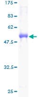Human CELA3B / ELA3B Protein (Recombinant GST)