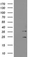 Monoclonal Mouse anti-Human MMACHC Antibody (clone OTI1E7, WB)