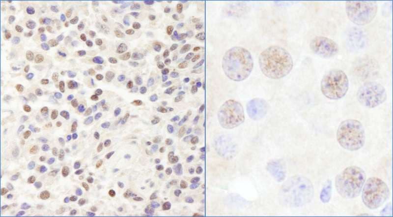 CHD3 Antibody (aa1950-2000)