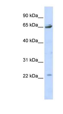 P2RX2 / P2X2 Antibody (aa323-372)