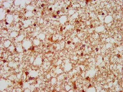 GTF3C5 Antibody
