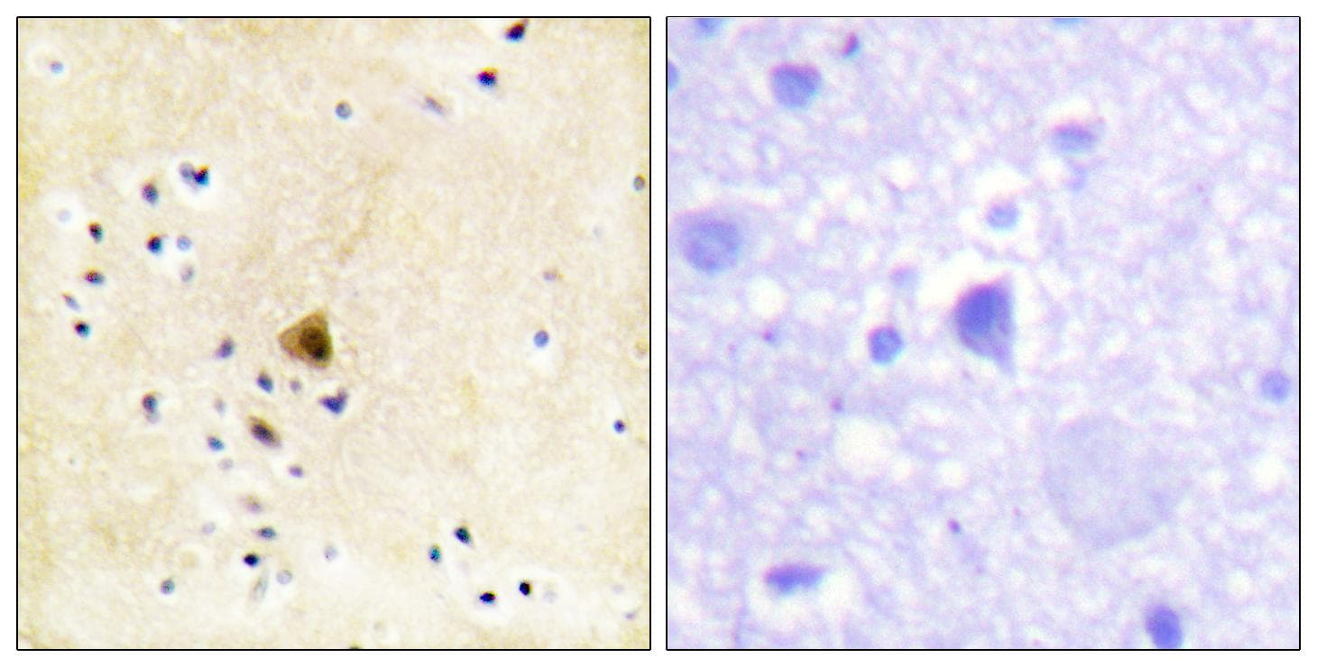 Polyclonal Rabbit anti-Human RYR2 / Ryanodine Receptor 2 Antibody (Ab-2808, IHC, IF)