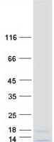 Human HIST3H2A Protein (Recombinant Myc-DDK (Flag))