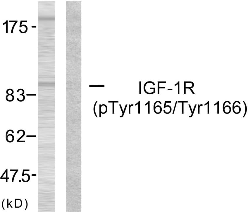 IGF1R / IGF1 Receptor Antibody (phospho-Tyr1165)