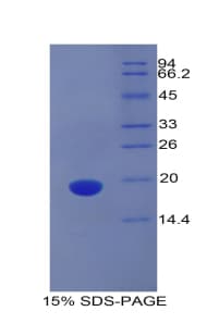 Mouse PROCR / EPCR Protein (Recombinant His)