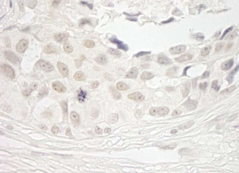 PPP1CB Antibody (aa280-C-term)