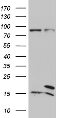 Monoclonal Mouse anti-Human SPC18 / SEC11A Antibody (clone OTI1A11, WB)