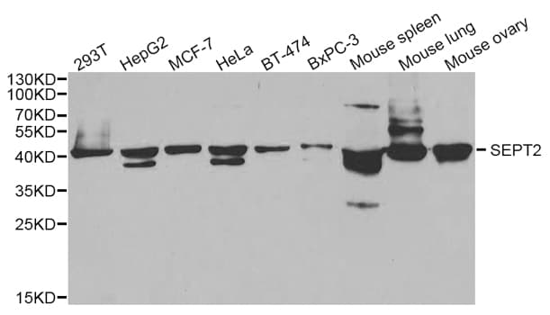 Polyclonal Rabbit anti-Human SEPT2 / Septin 2 Antibody (IHC, WB)