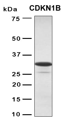 Human CDKN1B / p27 Kip1 Protein (Recombinant 6His, N-terminus)
