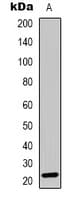 Polyclonal Rabbit anti-Human RGS1 Antibody (Internal, WB)